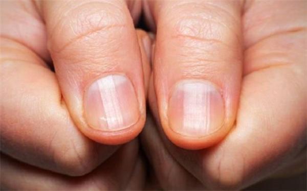 با این فرمول ناخن ها دو برابر رشد می کنند با این فرمول ناخن ها دو برابر رشد می نمایند